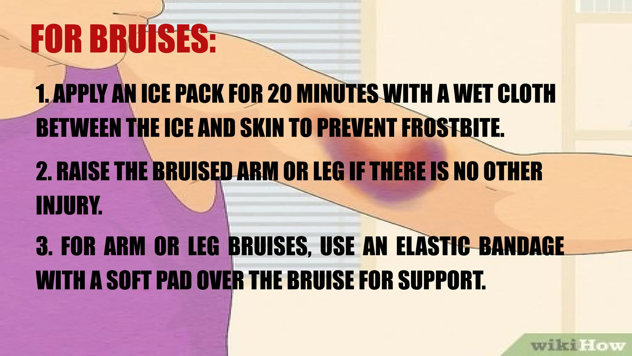 FOR BRUISES:
1. APPLY AN ICE PACK FOR 20 MINUTES WITH A WET CLOTH
BETWEEN THE ICE AND SKIN TO PREVENT FROSTBITE.
2. RAISE THE BRUISED ARM OR LEG IF THERE IS NO OTHER
INJURY.
3. FOR ARM OR LEG BRUISES, USE AN ELASTIC BANDAGE
WITH A SOFT PAD OVER THE BRUISE FOR SUPPORT.
 