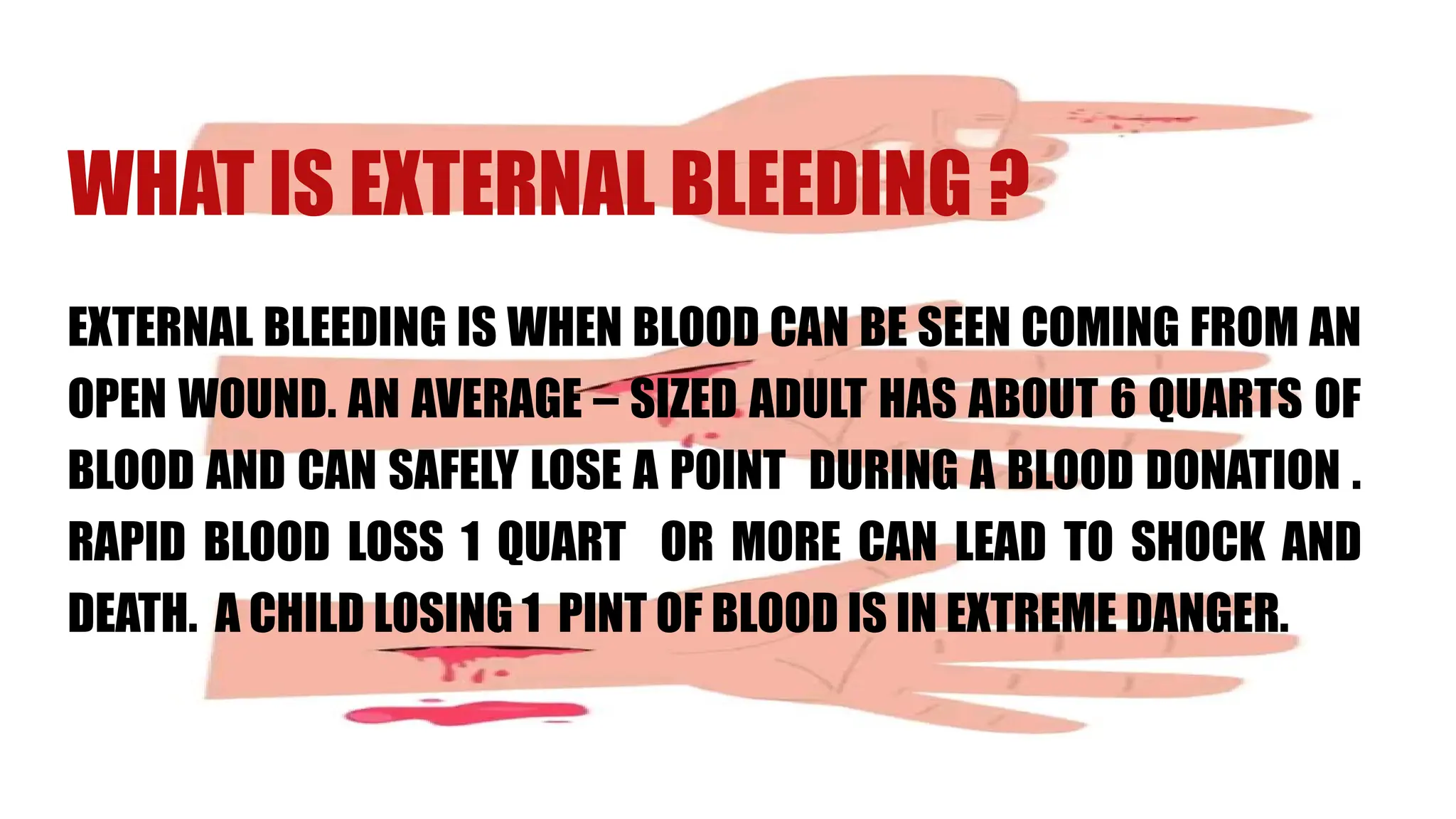 WHAT IS EXTERNAL BLEEDING ?
EXTERNAL BLEEDING IS WHEN BLOOD CAN BE SEEN COMING FROM AN
OPEN WOUND. AN AVERAGE – SIZED ADULT HAS ABOUT 6 QUARTS OF
BLOOD AND CAN SAFELY LOSE A POINT DURING A BLOOD DONATION .
RAPID BLOOD LOSS 1 QUART OR MORE CAN LEAD TO SHOCK AND
DEATH. A CHILD LOSING 1 PINT OF BLOOD IS IN EXTREME DANGER.
 