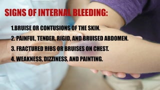 EXTERNAL AND INTERNAL BLEEDING. PPTX12890875 | PPTX