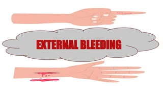 EXTERNAL AND INTERNAL BLEEDING. PPTX12890875 | PPTX