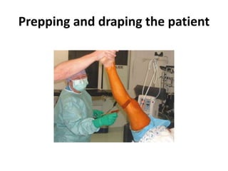 Prepping and draping the patient
 