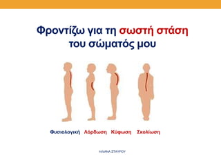 Φροντίζω για τη σωστή στάση
του σώματός μου
Φυσιολογική Λόρδωση Κύφωση Σκολίωση
ΗΛΙΑΝΑ ΣΤΑΥΡΟΥ
 