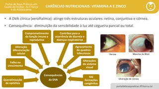 portaldeboaspraticas.iff.fiocruz.br
CARÊNCIAS NUTRICIONAIS: VITAMINA A E ZINCO
Consequências
da DVAQueratinização
de epitélios
Falha no
crescimento
Alteração
diferenciação
celular
Comprometimento
da função imune e
reprodutiva
Contribui para a
ocorrência de diarreia e
doenças respiratórias
Agravamento
de quadros
infecciosos
Alterações
do sistema
visual
Má
formações
congênitas
• A DVA clínica (xeroftalmia): atinge três estruturas oculares: retina, conjuntiva e córnea.
• Consequência: diminuição da sensibilidade à luz até cegueira parcial ou total.
 