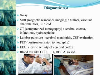 Diagnostic test
 X-ray
 MRI (magnetic resonance imaging) : tumors, vascular
abnormalities, IC bleed
 CT (computerized tomography) : cerebral edema,
infarctions, hydrocephalus
 Lumbar puncture : cerebral meningitis, CSF evaluation
 PET (positron emission tomography)
 EEG: electric activity of cerebral cortex
 Blood test like CBC, LFT, RFT, ABG etc.
 