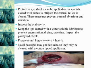  Protective eye shields can be applied or the eyelids
closed with adhesive strips if the corneal reflex is
absent. These measures prevent corneal abrasions and
irritation.
 Inspect the oral cavity.
 Keep the lips coated with a water-soluble lubricant to
prevent encrustation, drying, cracking. Inspect the
paralyzed cheek.
 Frequent oral hygiene every 4 hourly.
 Nasal passages may get occluded so they may be
cleaned with a cotton tipped applicator.
 