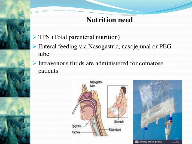 Care Of An Unconcious Patient