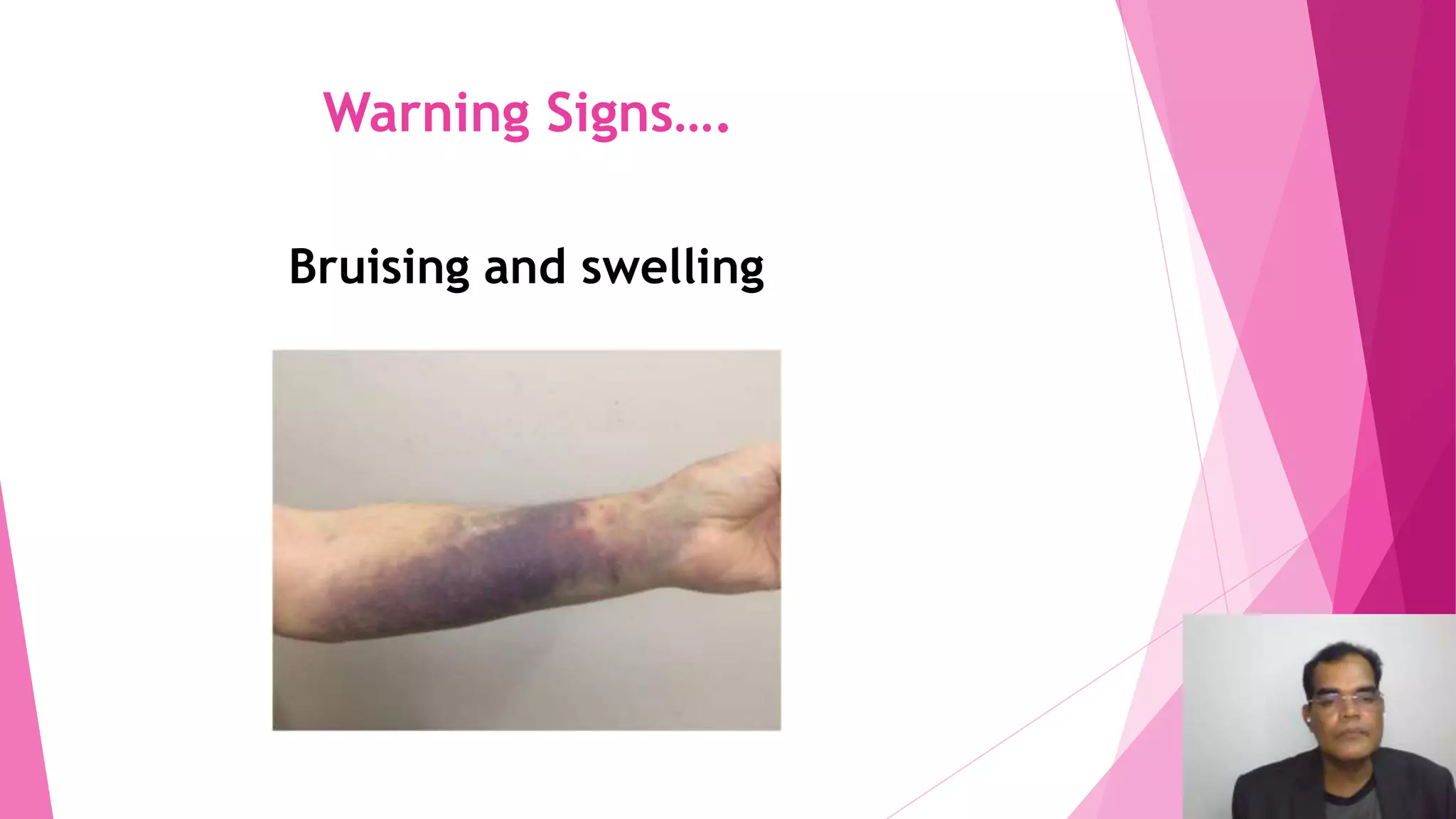 Care of AV Fistula (with explanation on download).pptx