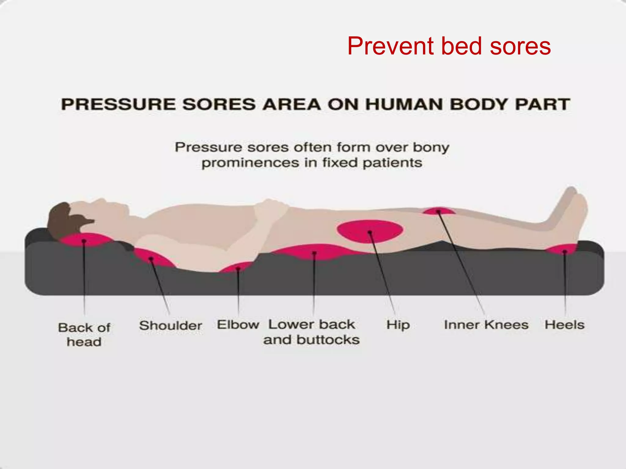 Care of bedridden patient | PPTX