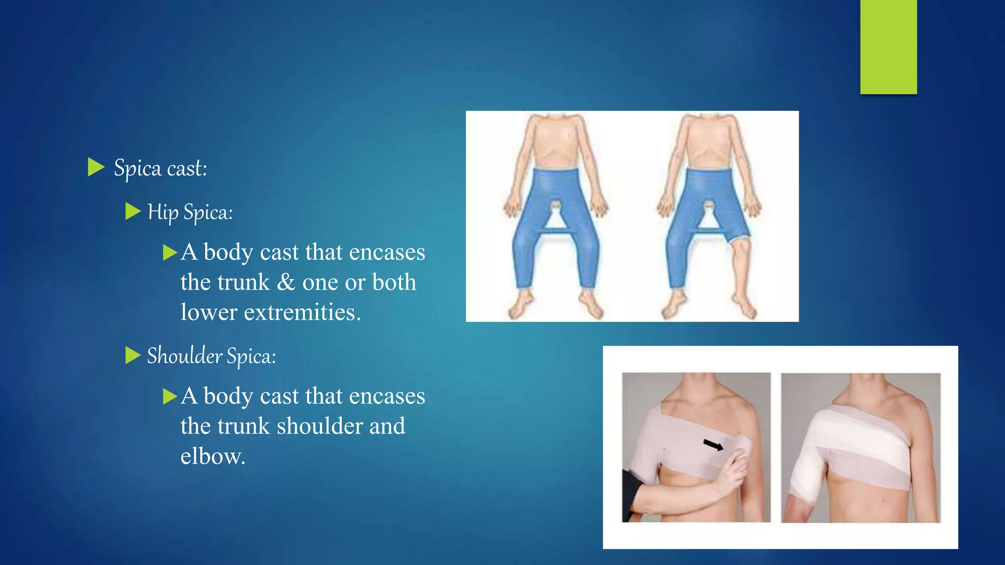 Care_of_clients_with_cast_and_splints.pptx