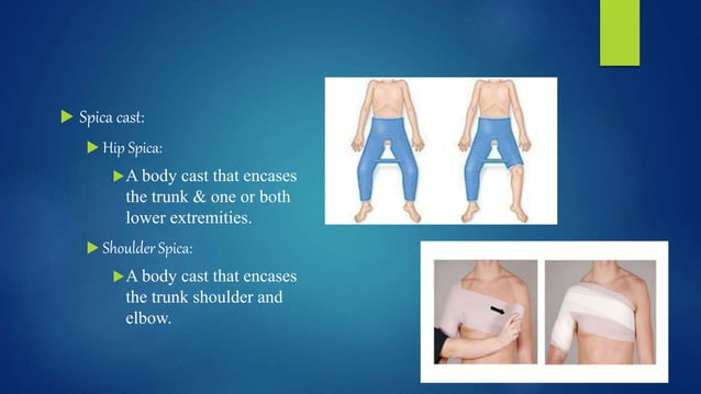 Care_of_clients_with_cast_and_splints.pptx