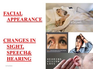 FACIAL
APPEARANCE
CHANGES IN
SIGHT,
SPEECH&
HEARING
74/14/2016
 