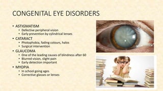 Care of eyes | PPTX