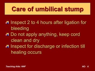 Teaching Aids: NNF NC- 6
Care of umbilical stump
Inspect 2 to 4 hours after ligation for
bleeding
Do not apply anything, keep cord
clean and dry
Inspect for discharge or infection till
healing occurs
 