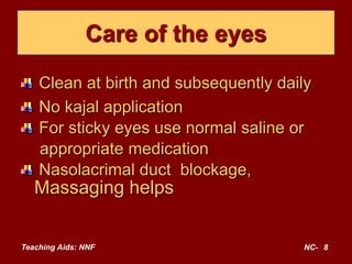 Teaching Aids: NNF NC- 8
Care of the eyes
Clean at birth and subsequently daily
No kajal application
For sticky eyes use normal saline or
appropriate medication
Nasolacrimal duct blockage,
Massaging helps
 
