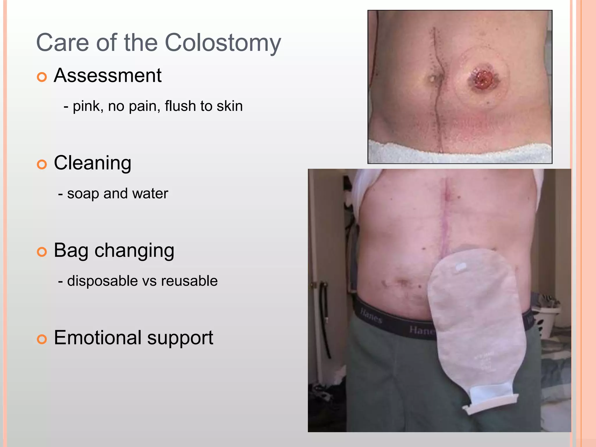 Safety Guidelines: During & After a Winter Storm