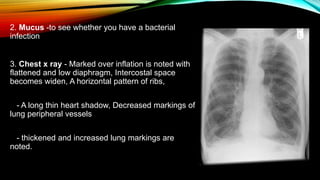 COPD | PPTX