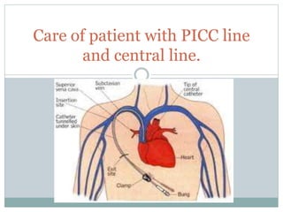 Care of patient with PICC line
and central line.
 