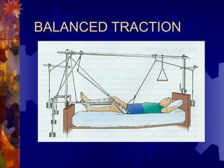 care of patient with traction for students | PPTX