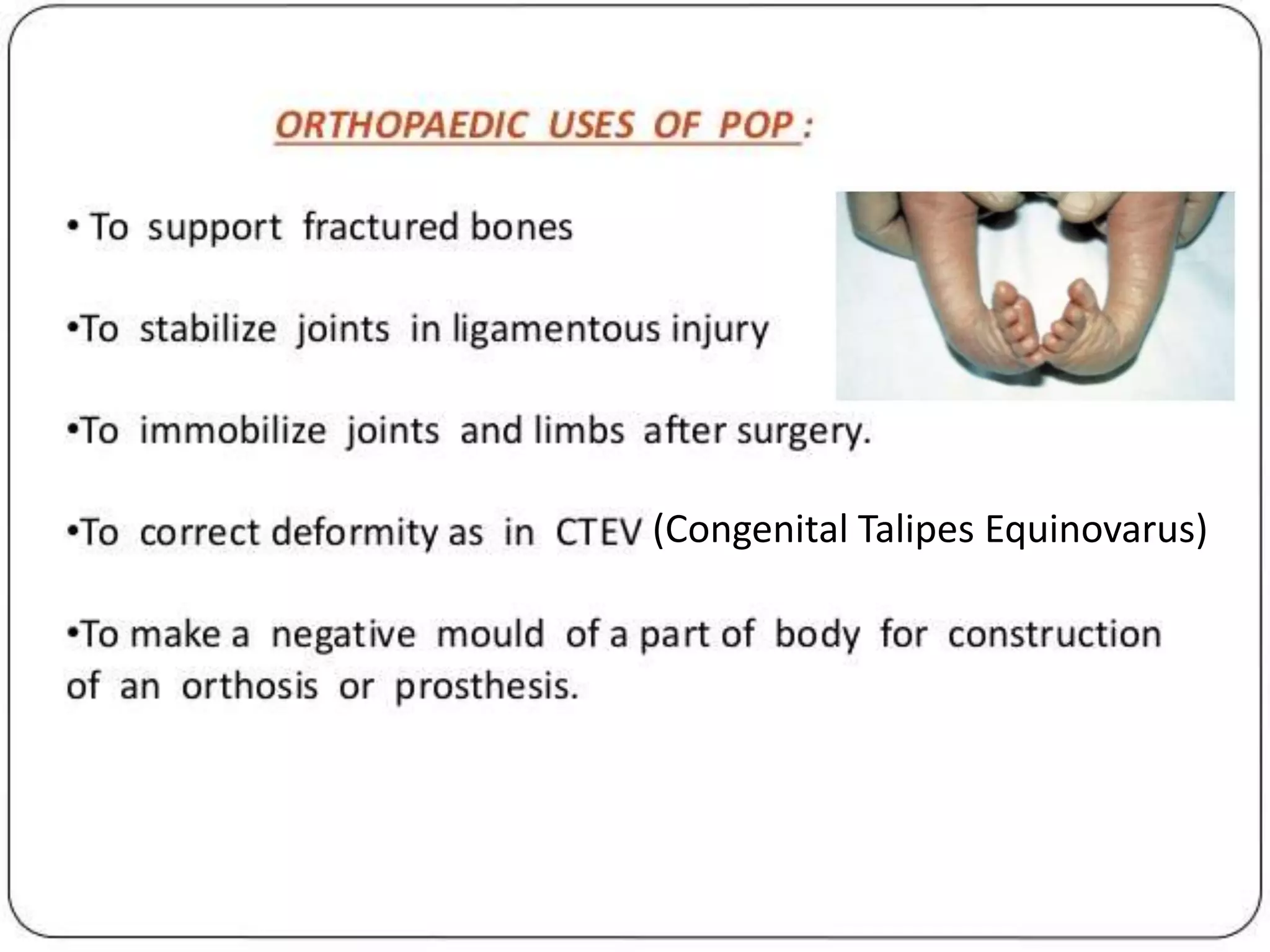 (Congenital Talipes Equinovarus)
 