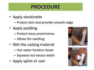 PROCEDURE
• Apply stockinette
– Protect skin and provide smooth edge
• Apply padding
– Protect bony prominence
– Allows for swelling
• Wet the casting material
– Hot water hardens faster
– Squeeze out excess water
• Apply splint or cast