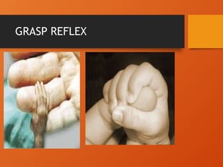 GRASP REFLEX
 