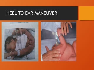 HEEL TO EAR MANEUVER
 