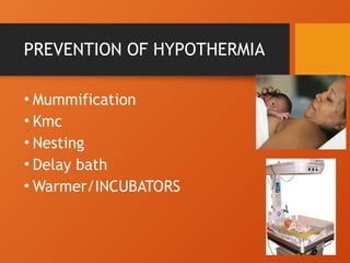 PREVENTION OF HYPOTHERMIA
• Mummification
• Kmc
• Nesting
• Delay bath
• Warmer/INCUBATORS
 