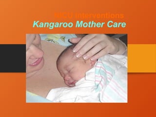 NICU Interventions
Kangaroo Mother Care
 