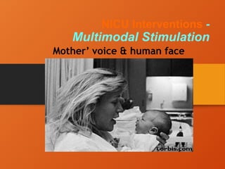 NICU Interventions -
Multimodal Stimulation
Mother’ voice & human face
 