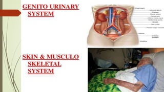 Care of terminally ill | PPTX