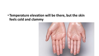 • Temperature elevation will be there, but the skin
feels cold and clammy
 