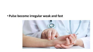 • Pulse become irregular weak and fast
 