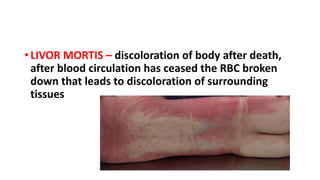 • LIVOR MORTIS – discoloration of body after death,
after blood circulation has ceased the RBC broken
down that leads to discoloration of surrounding
tissues
 