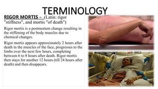 TERMINOLOGY
RIGOR MORTIS – (Latin: rigor
"stiffness", and mortis "of death")
Rigor mortis is a postmortem change resulting in
the stiffening of the body muscles due to
chemical changes.
Rigor mortis appears approximately 2 hours after
death in the muscles of the face, progresses to the
limbs over the next few hours, completing
between 6 to 8 hours after death. Rigor mortis
then stays for another 12 hours (till 24 hours after
death) and then disappears.
 