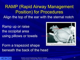 Care of the bariatric patient for the OR Nurse | PPT | Diabetes ...