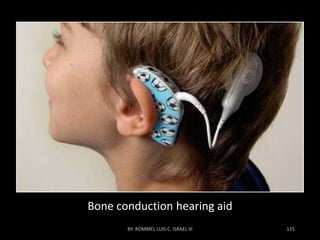 Bone conduction hearing aid
 