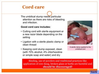 Care of the normal newborn | PPTX