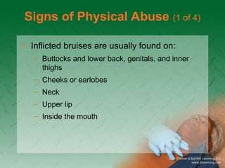 Signs of Physical Abuse (1 of 4)
• Inflicted bruises are usually found on:
– Buttocks and lower back, genitals, and inner
thighs
– Cheeks or earlobes
– Neck
– Upper lip
– Inside the mouth
 
