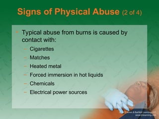 Signs of Physical Abuse (2 of 4)
• Typical abuse from burns is caused by
contact with:
– Cigarettes
– Matches
– Heated metal
– Forced immersion in hot liquids
– Chemicals
– Electrical power sources
 