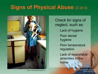 Signs of Physical Abuse (3 of 4)
• Check for signs of
neglect, such as:
– Lack of hygiene
– Poor dental
hygiene
– Poor temperature
regulation
– Lack of reasonable
amenities in the
home
Source: © Jeff Greenberg/PhotoEdit, Inc.
 