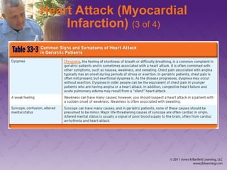 Heart Attack (Myocardial
Infarction) (3 of 4)
 