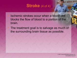 Stroke (4 of 4)
• Ischemic strokes occur when a blood clot
blocks the flow of blood to a portion of the
brain.
• The treatment goal is to salvage as much of
the surrounding brain tissue as possible.
 