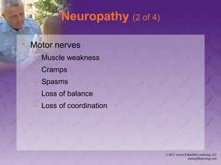 Neuropathy (2 of 4)
• Motor nerves
– Muscle weakness
– Cramps
– Spasms
– Loss of balance
– Loss of coordination
 