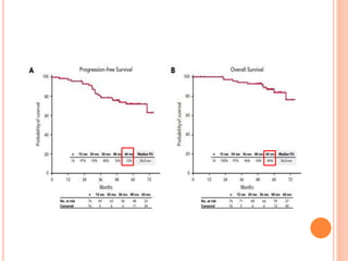 Carfilzomib In Newly Diagnosed Multiple Myeloma.pptx