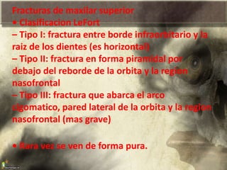 Fracturas de maxilar superior
• Clasificacion LeFort
– Tipo I: fractura entre borde infraorbitario y la
raiz de los dientes (es horizontal)
– Tipo II: fractura en forma piramidal por
debajo del reborde de la orbita y la region
nasofrontal
– Tipo III: fractura que abarca el arco
cigomatico, pared lateral de la orbita y la region
nasofrontal (mas grave)
• Rara vez se ven de forma pura.
 