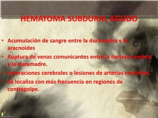 HEMATOMA SUBDURAL AGUDO
• Acumulación de sangre entre la duramadre y la
aracnoides
• Ruptura de venas comunicantes entre la corteza cerebral
y la duramadre.
• Laceraciones cerebrales o lesiones de arterias corticales.
• Se localiza con más frecuencia en regiones de
contragolpe.
 