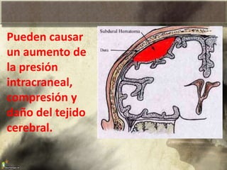 Pueden causar
un aumento de
la presión
intracraneal,
compresión y
daño del tejido
cerebral.
 