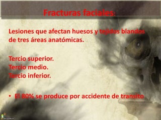 Fracturas faciales:
Lesiones que afectan huesos y tejidos blandos
de tres áreas anatómicas.
Tercio superior.
Tercio medio.
Tercio inferior.
• El 80% se produce por accidente de transito
 