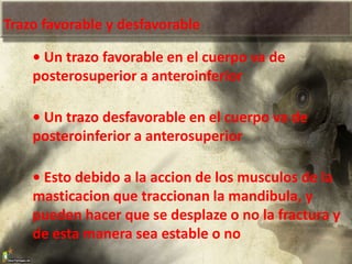 Trazo favorable y desfavorable
• Un trazo favorable en el cuerpo va de
posterosuperior a anteroinferior
• Un trazo desfavorable en el cuerpo va de
posteroinferior a anterosuperior
• Esto debido a la accion de los musculos de la
masticacion que traccionan la mandibula, y
pueden hacer que se desplaze o no la fractura y
de esta manera sea estable o no
 