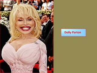 Dolly Parton
 